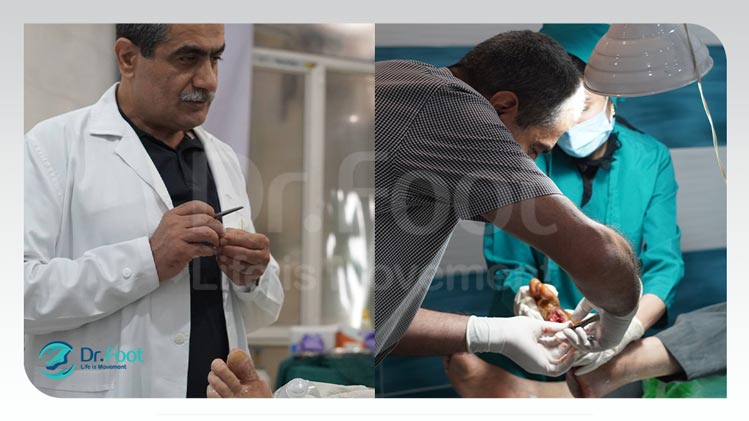 کلینیک زخم پای دیابتی در تهران: راهنمای جامع برای مدیریت و درمان