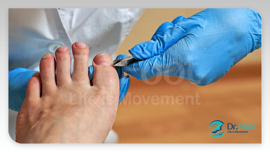 دکتر ناخن پا تهران: راهنمایی‌های ارزشمند برای بهبود سلامتی پاهای شما
