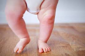 کج گذاشتن پا به سمت داخل در کودکان: علل، تشخیص و درمان