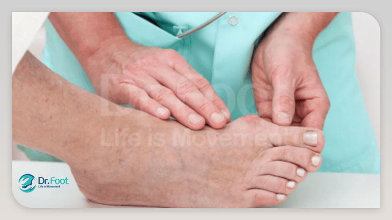 رشد اضافی استخوان انگشت پا چیست