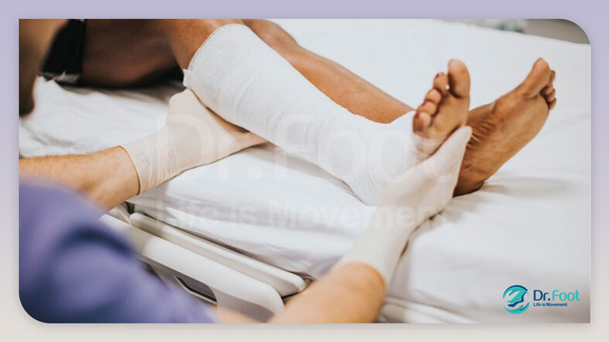 افزایش خطر در کوفتگی پا در اثر