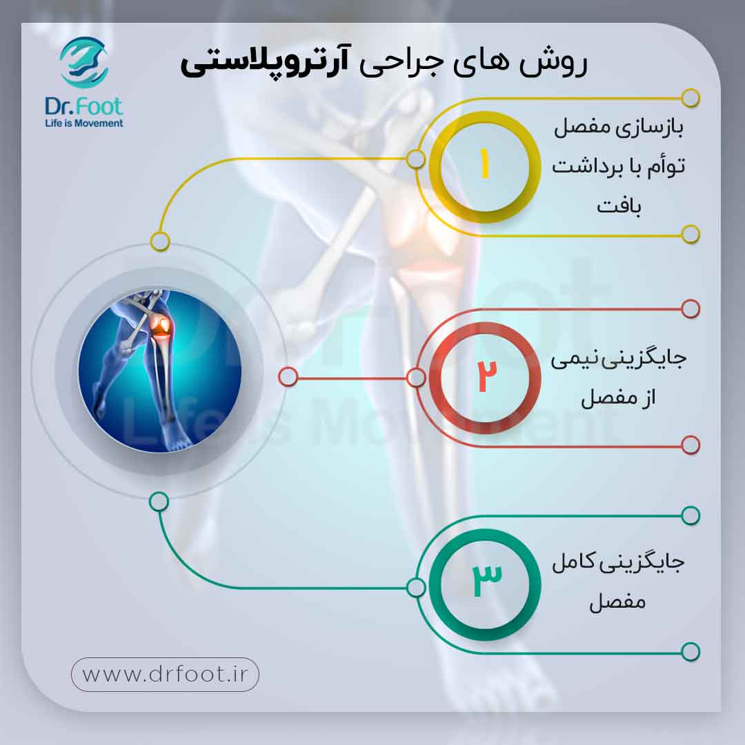 روش های جراحی آرتروپلاستی یا بازسازی مفصل