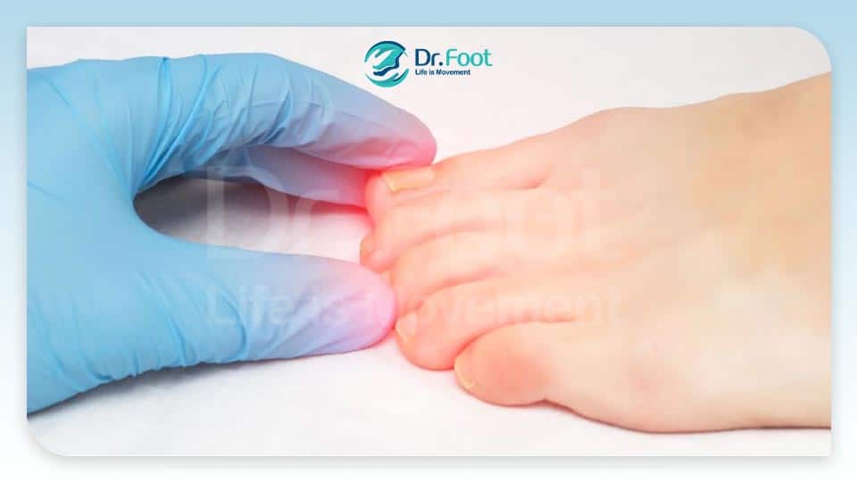 علت درد انگشت پا: علایم، عوامل و راه‌حل‌ها