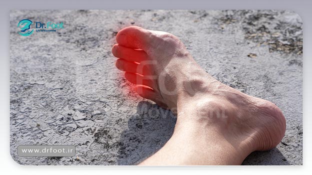 درمان درد انگشت پا: راه‌های موثر برای کاهش درد و بهبود عملکرد