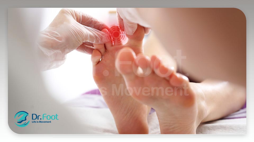 التهاب مفصلی علت درد انگشت دوم پا راست